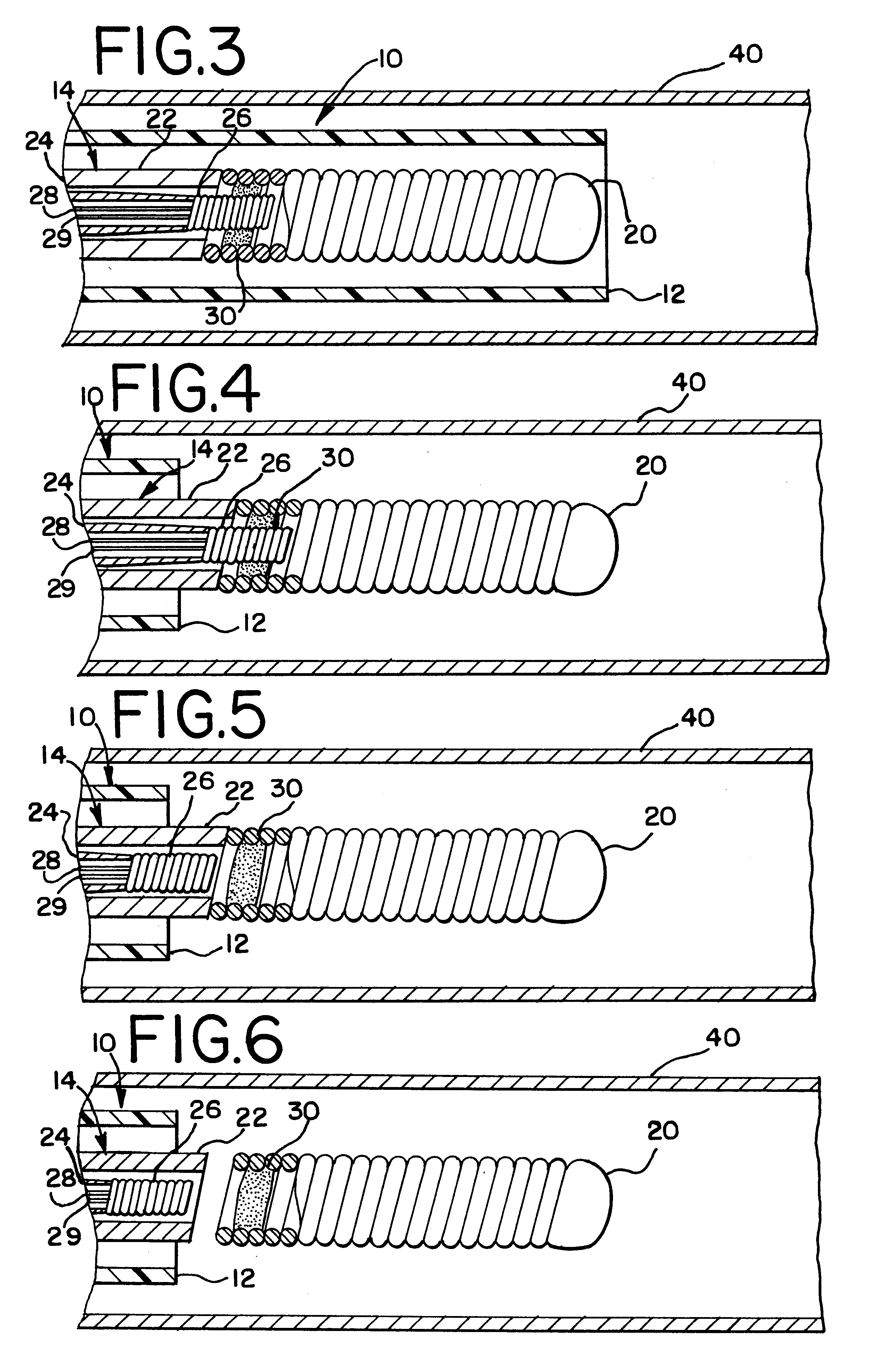 Heated vascular occlusion coil development system