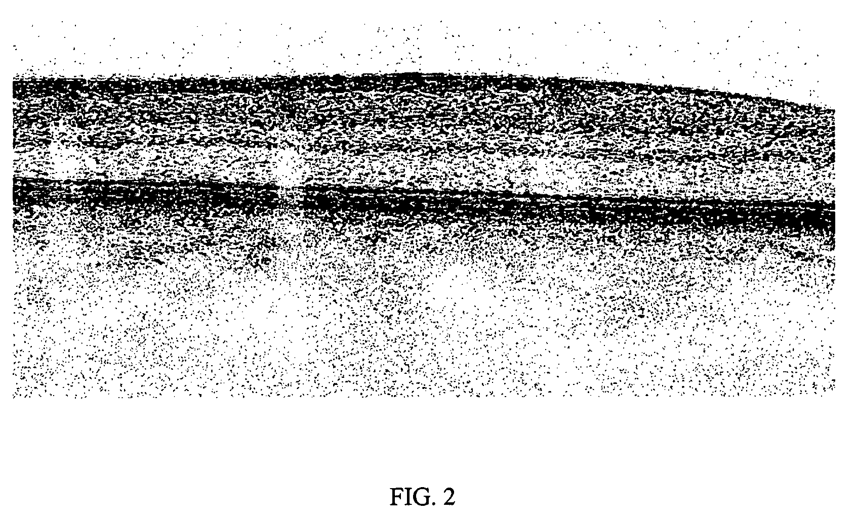 Method of motion correction in optical coherence tomography imaging
