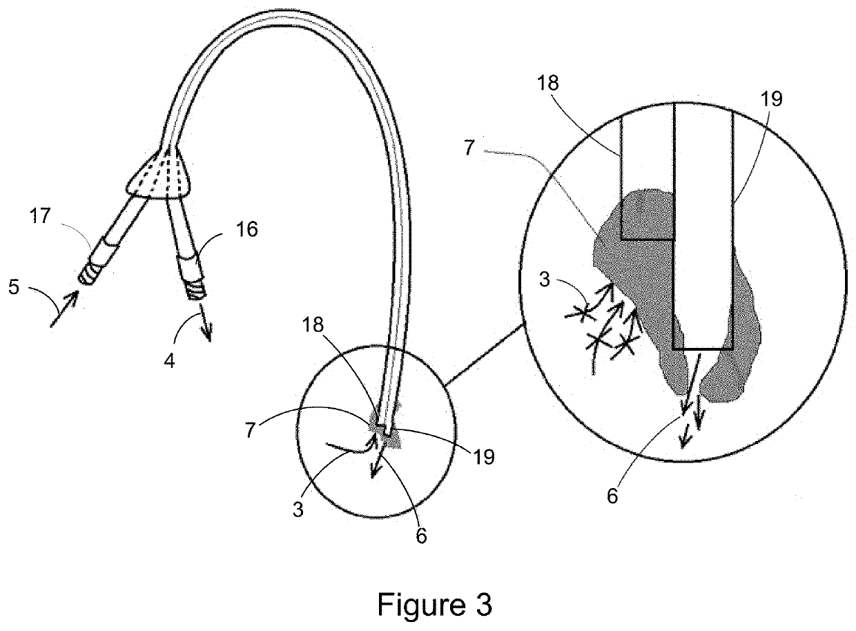 Catheter Clearance Device and Method of Use