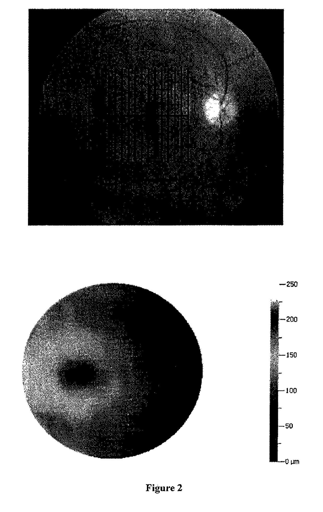 Methods for diagnosing glaucoma utilizing combinations of FD-OCT measurements from three anatomical regions of the eye