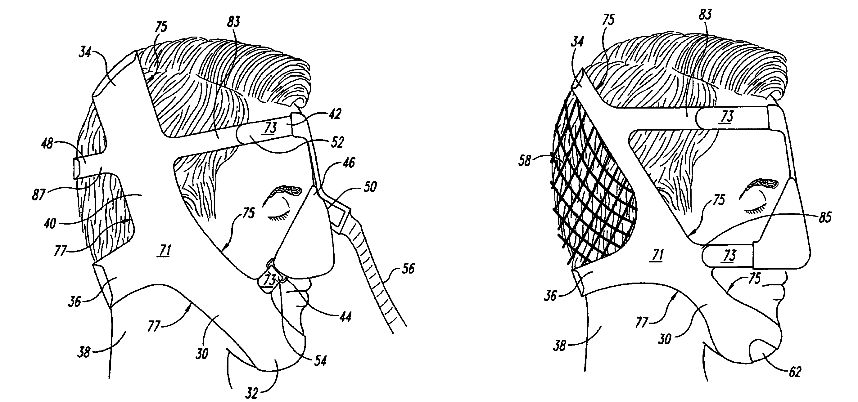 Headgear apparatus