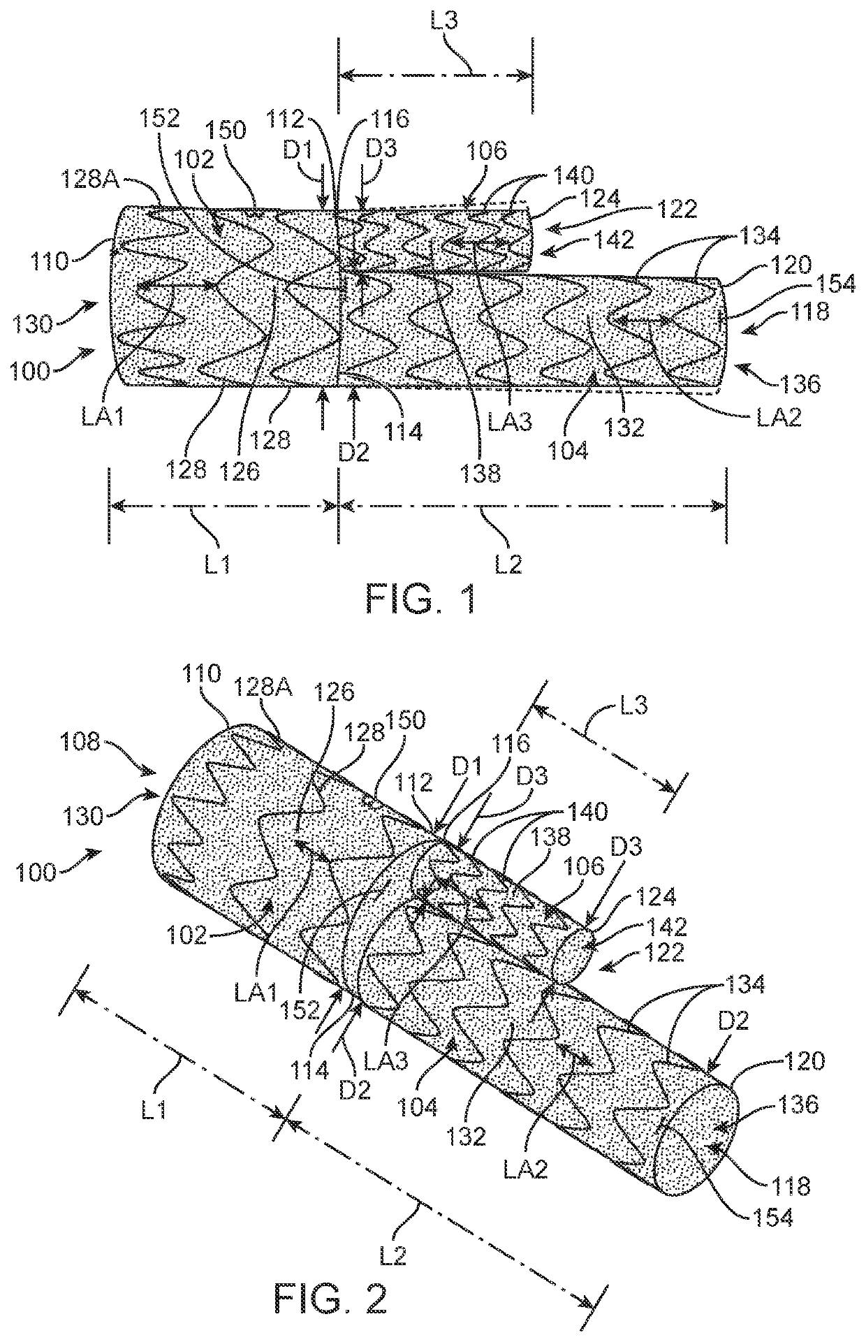 Femoral aortic access modular stent assembly and method