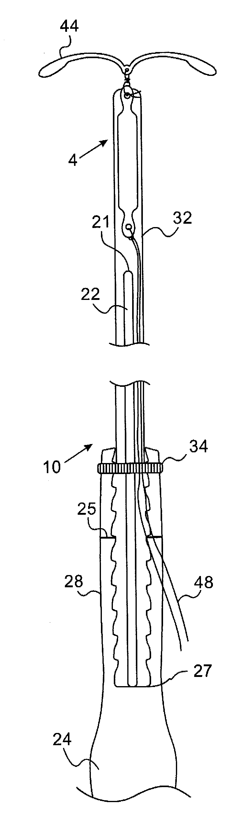Intrauterine device and inserter for the same