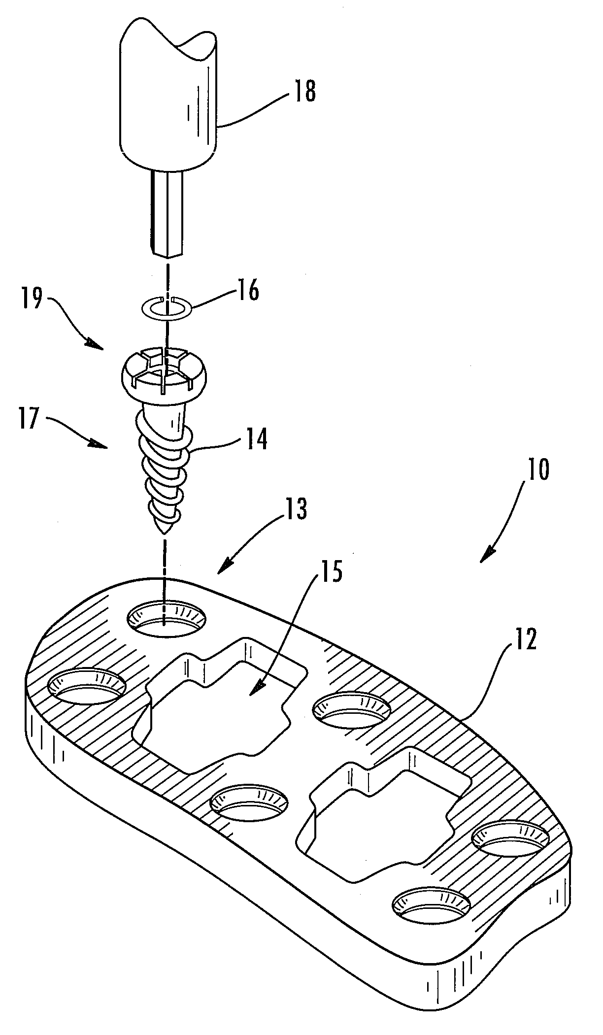 Cervical plate locking mechanism and associated surgical method