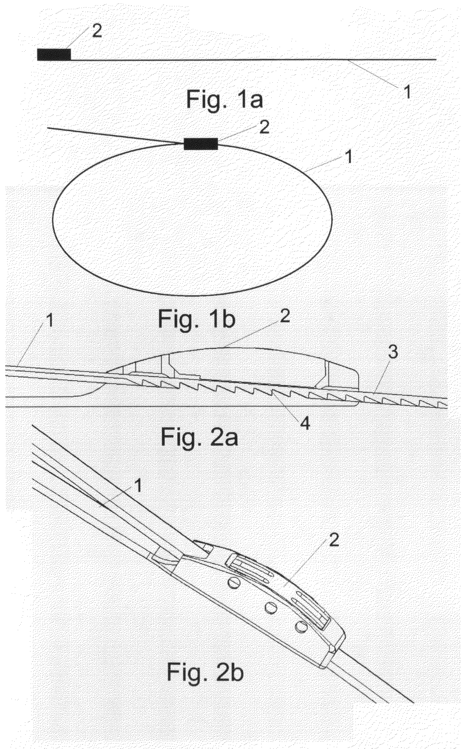 Bioabsorbable band system,a bioabsorbable band, a method for producing a bioabsorbable band, a needle system of a bioabsorbable band and a locking mechanism