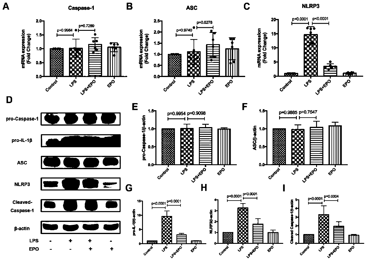 NLRP3 inflammasome inhibitor and application thereof