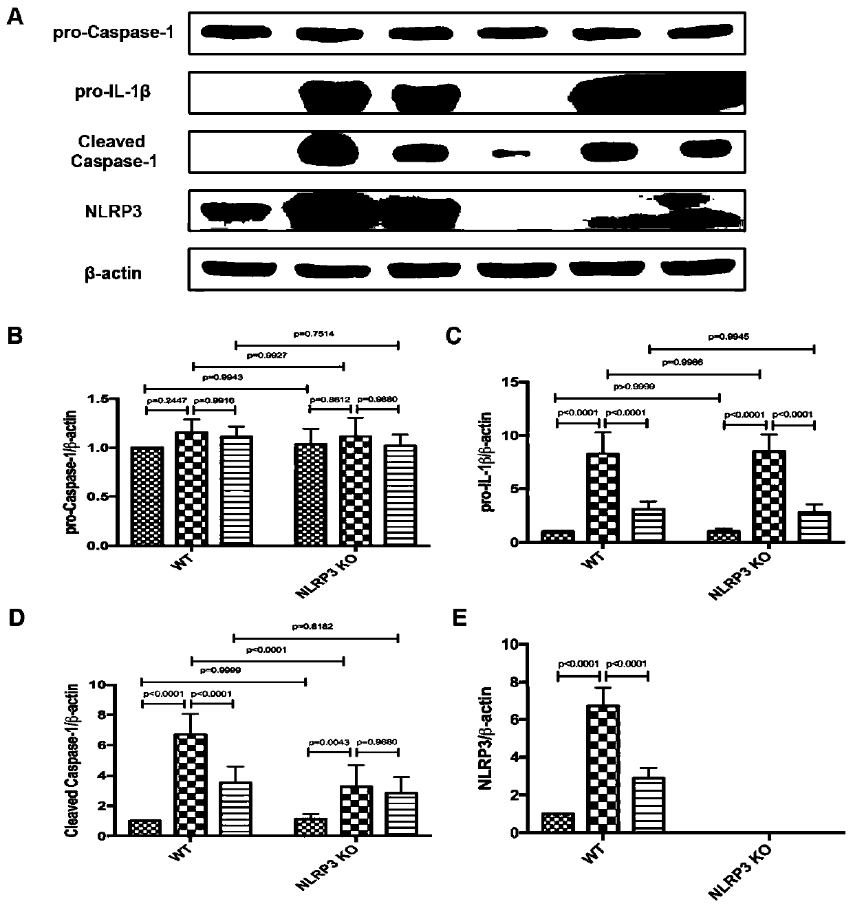 NLRP3 inflammasome inhibitor and application thereof
