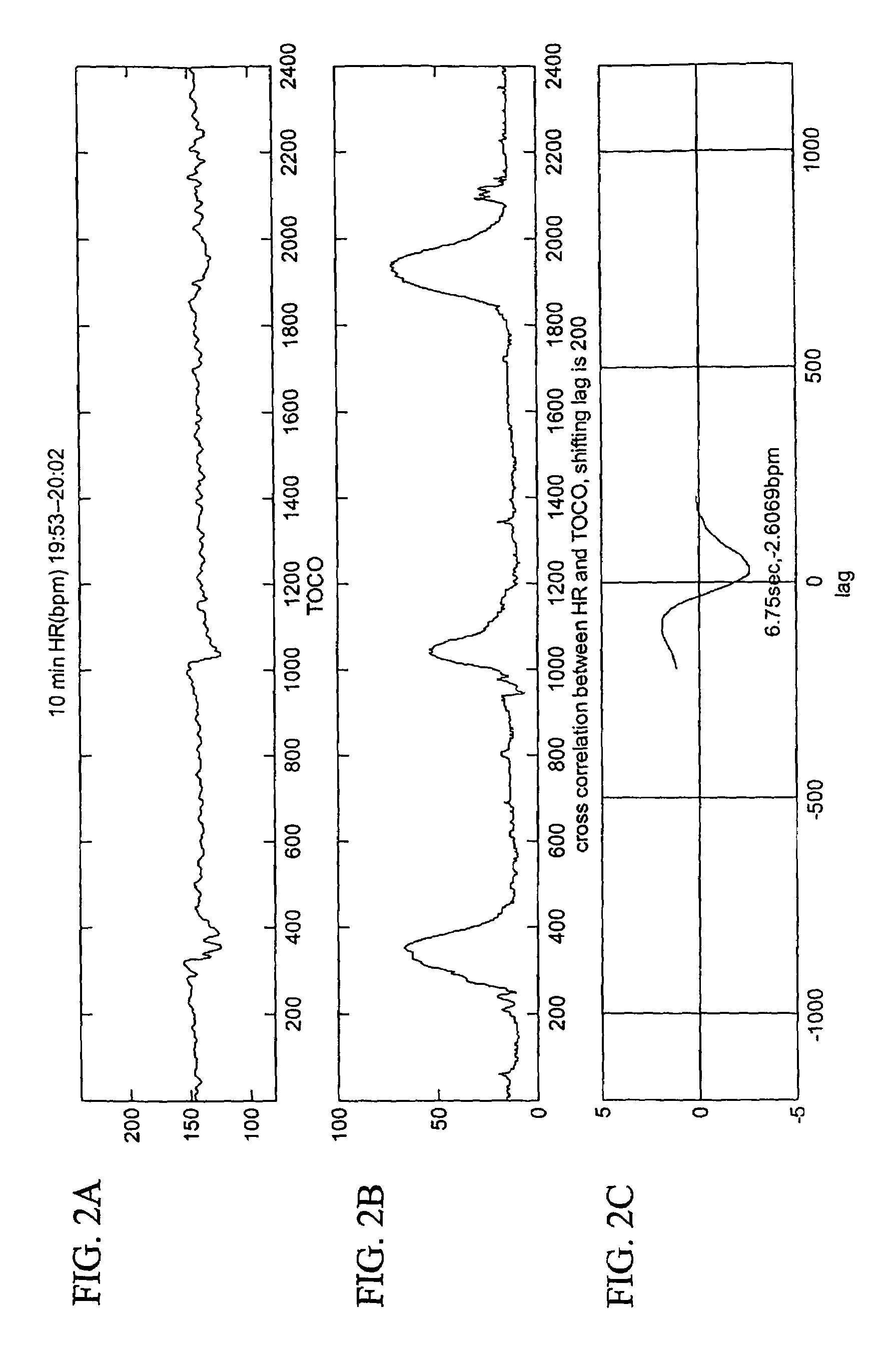 Quantitative fetal heart rate and cardiotocographic monitoring system and related method thereof