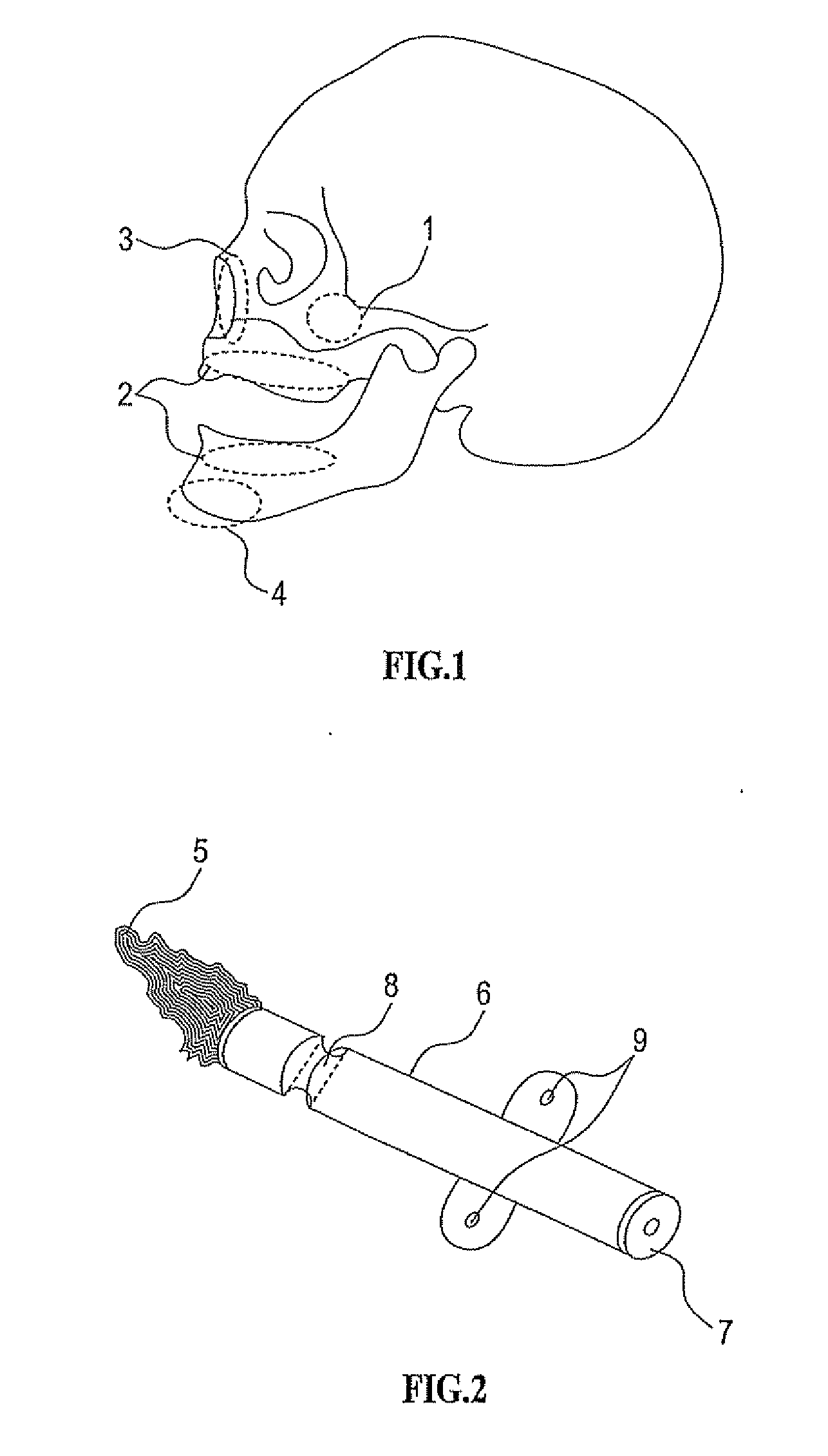 Bioresorbable inflatable devices, incision tool and methods for tissue expansion and tissue regeneration