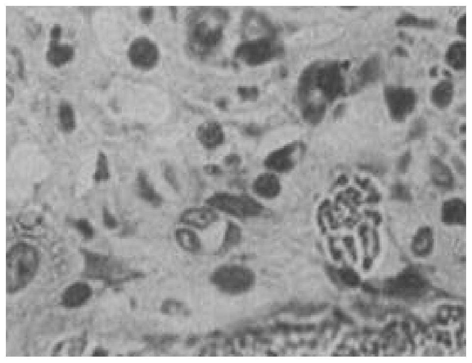 A kind of composite bone repair material and preparation method thereof