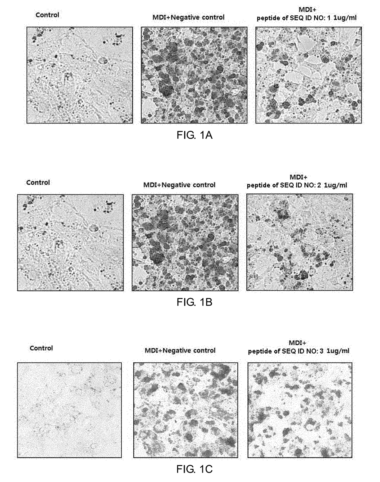 Peptide with Anti-obesity and Anti-diabetes activity and use thereof