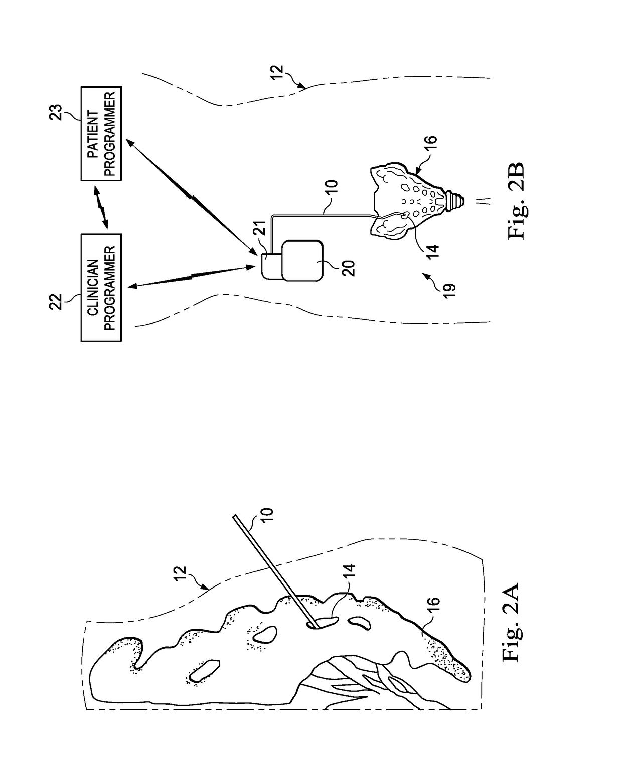 Systems, methods, and devices for performing electronically controlled test stimulation