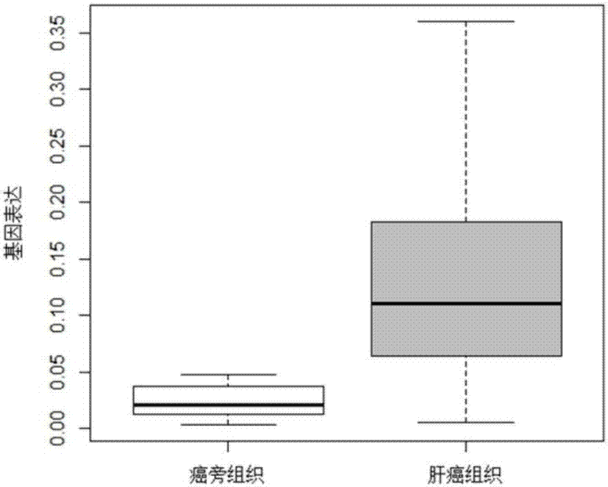 Gene related to liver cancer and application thereof