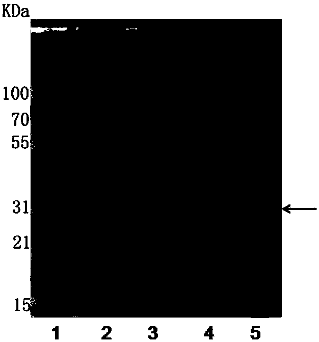 .Human c-reactive protein colloidal gold quantitative detection card