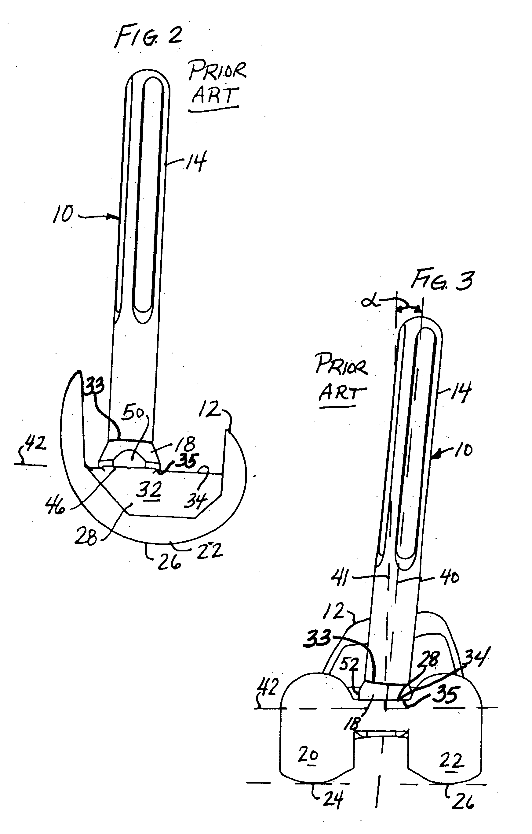 Modular orthopaedic implant system with multi-use stems