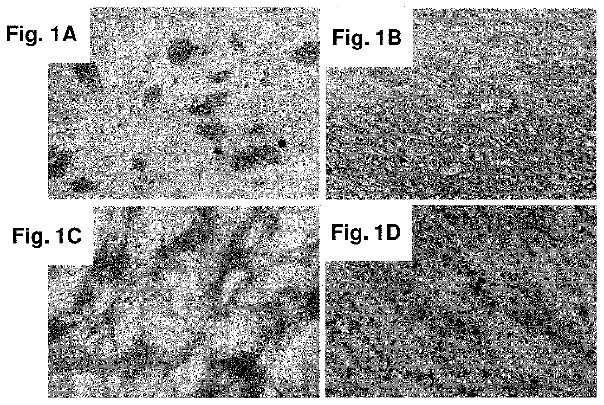 Adult Stem Cell Line Introduced with Hepatocyte Growth Factor Gene and Neurogenic Transcription Factor Gene with Basic Helix-Loop-Helix Motif and Uses Thereof