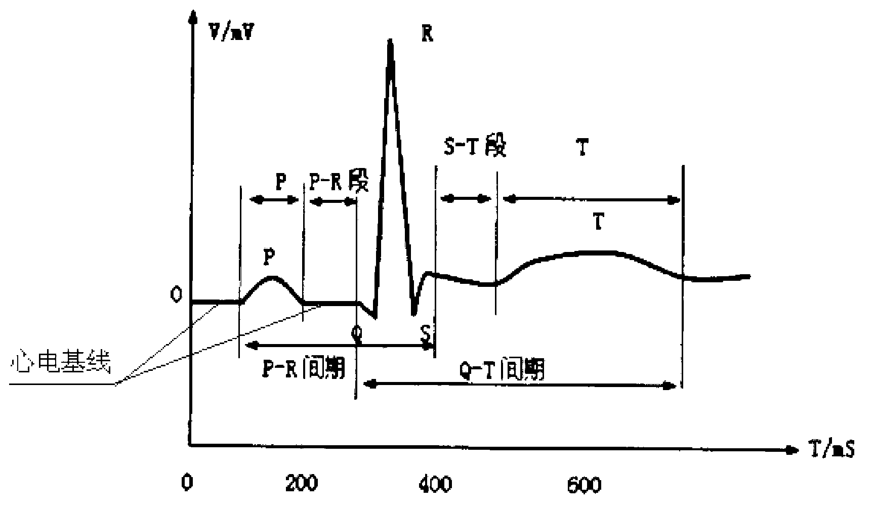 Method and device for calibrating R wave of electrocardiosignal