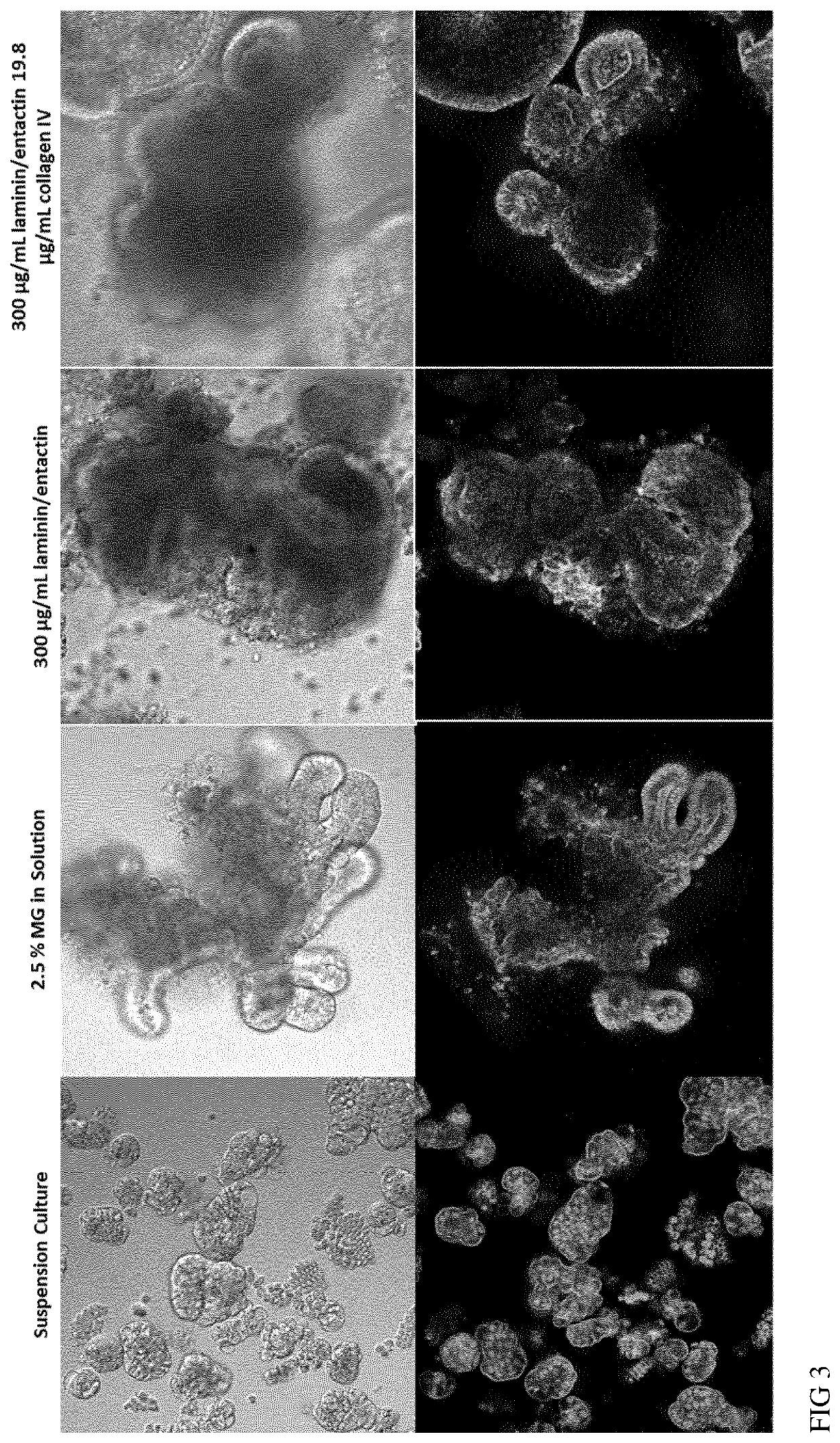 Cell culture medium and method for generation of epithelial organoids from epithelial stem cells