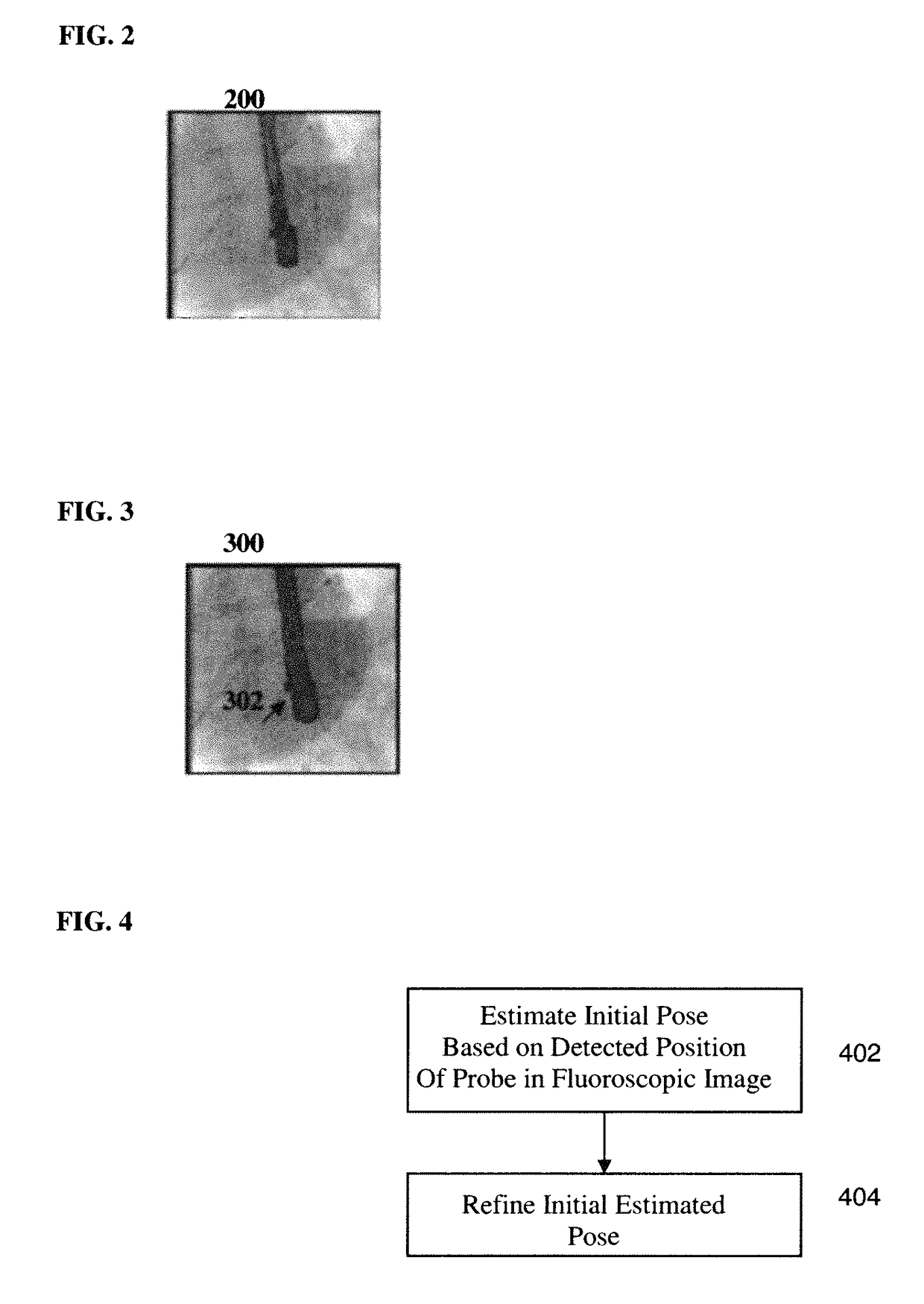 Method and system for registration of ultrasound and physiological models to X-ray fluoroscopic images