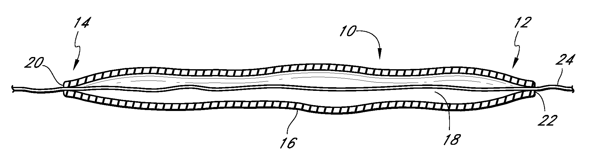 Tissue implant having a biased layer and compliance that simulates tissue