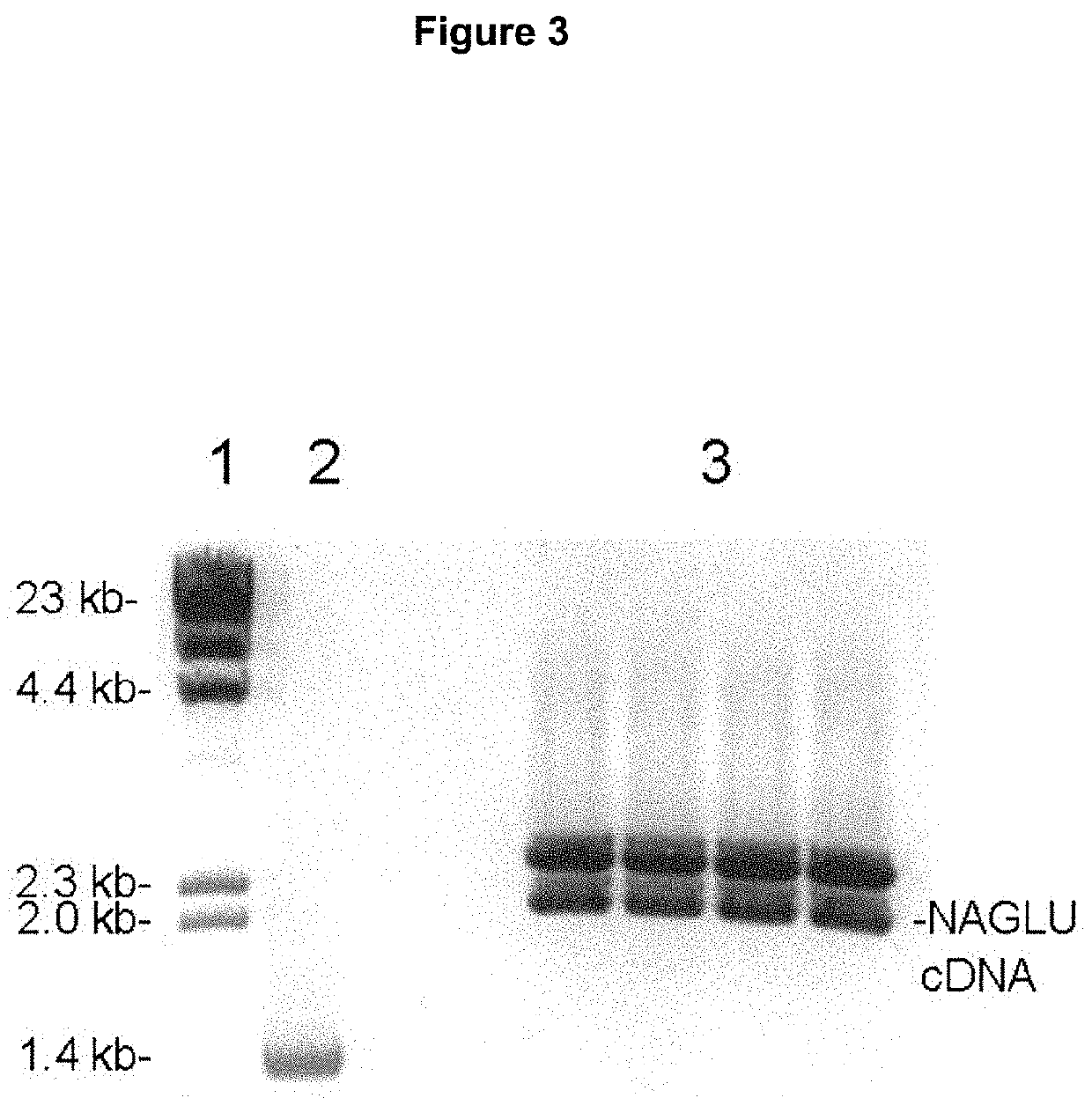Methods and compositions for increasing n-acetylglucosaminidase activity in the CNS