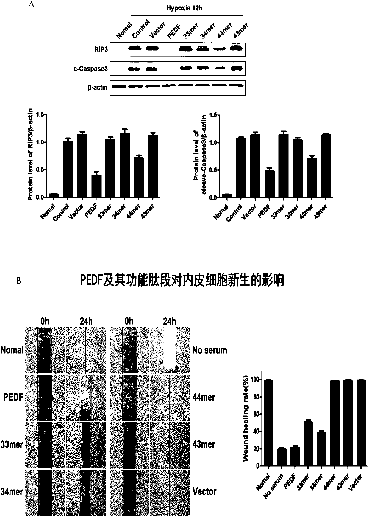 Use of derived polypeptide series of pigment epithelium derived factors in ischemic myocardium protection