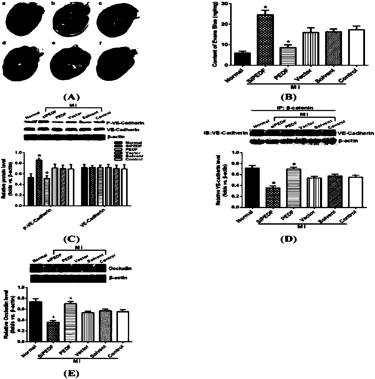 Use of derived polypeptide series of pigment epithelium derived factors in ischemic myocardium protection