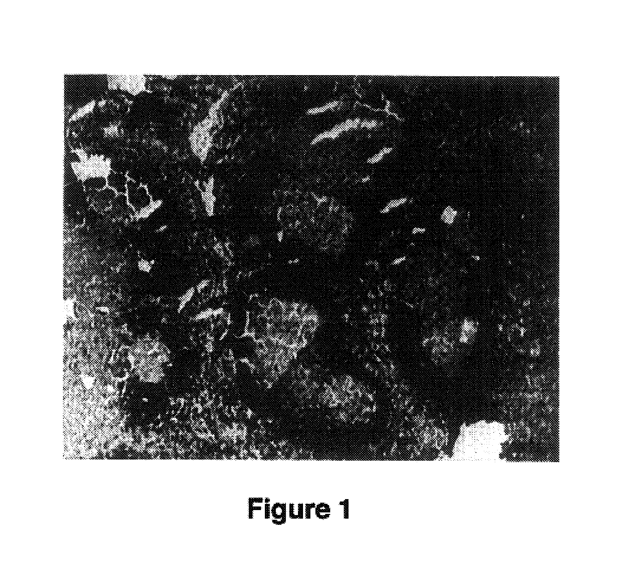 Antibodies against epitopes with homology to self antigens, methods of preparation and applications thereof