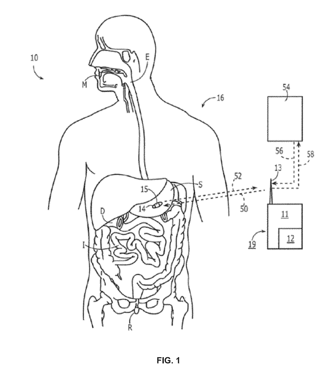 Ingestible bio-telemetry communication network and associated systems