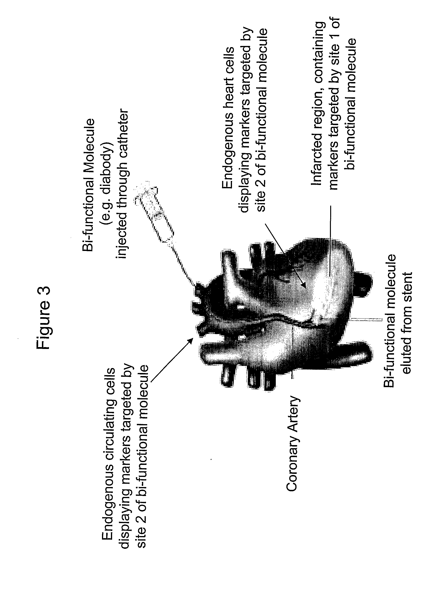 Methods of treating and preventing acute myocardial infarction