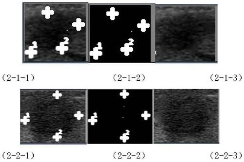 Ultrasonic image thyroid nodule intelligent detection system based on Fast-RCNN