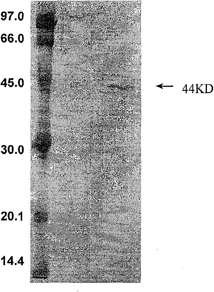 Three cotton ABF/AREB/ABI5/DPBF type transcription factors and coding genes and application thereof