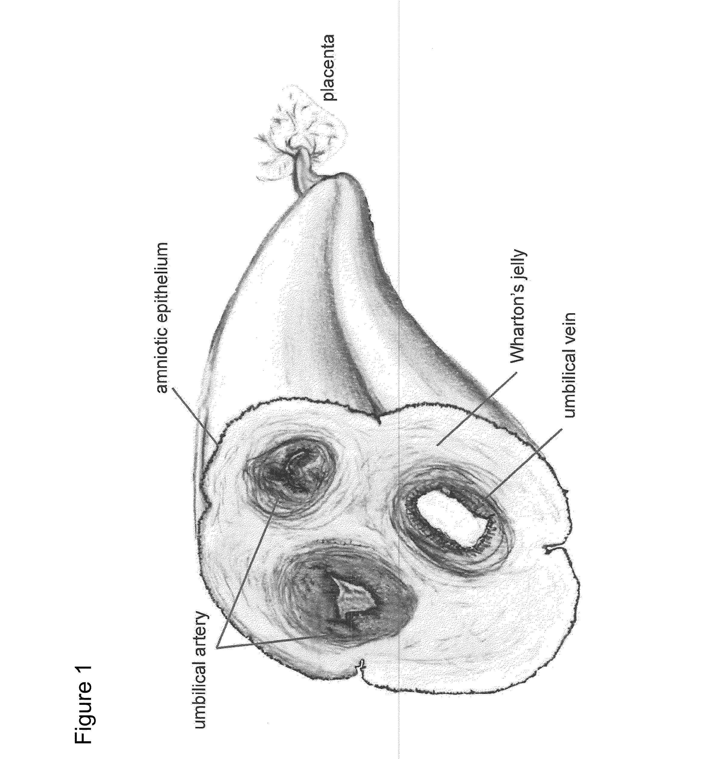 Method and apparatus for recovery of umbilical cord tissue derived regenerative cells and uses thereof