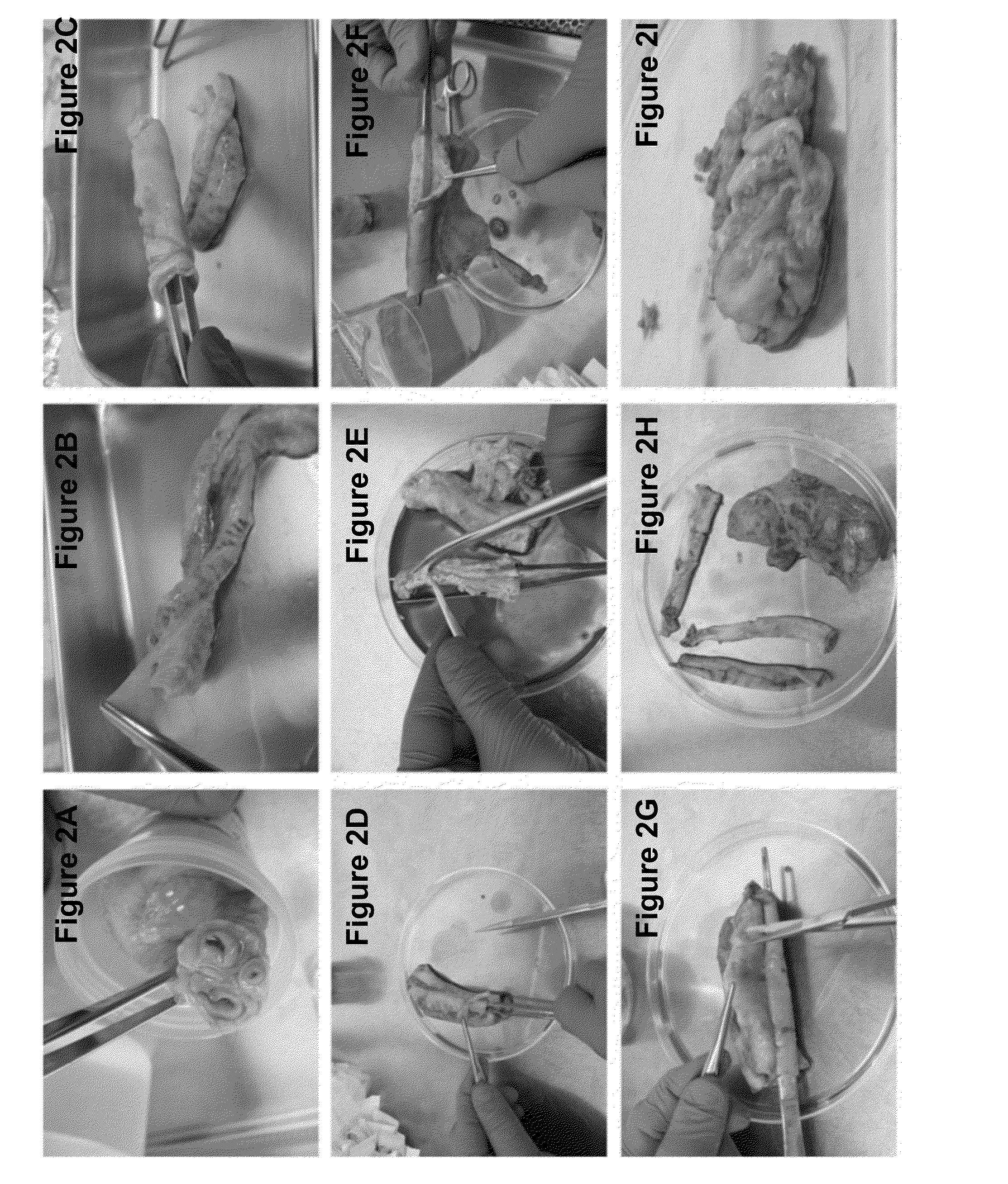 Method and apparatus for recovery of umbilical cord tissue derived regenerative cells and uses thereof