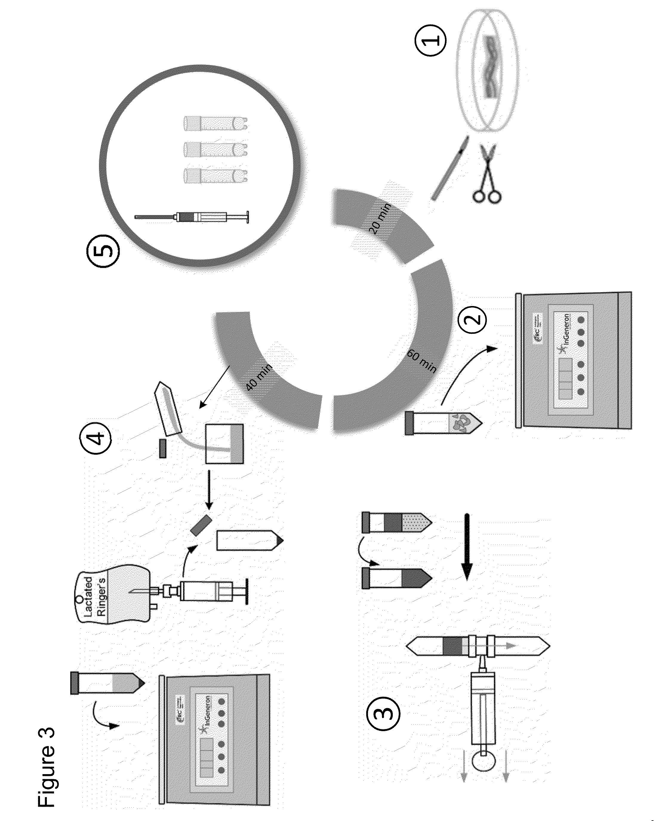 Method and apparatus for recovery of umbilical cord tissue derived regenerative cells and uses thereof