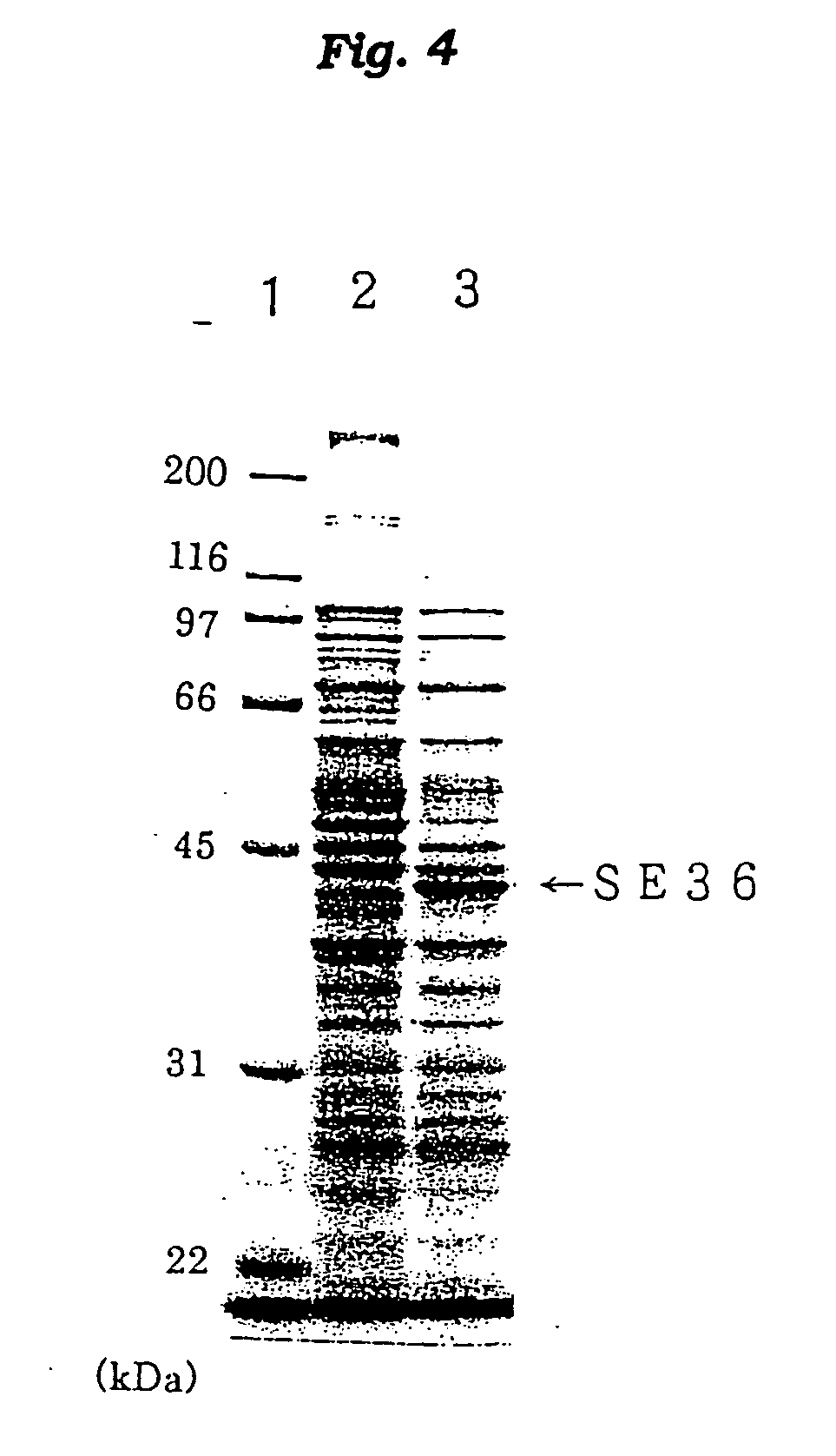 Antigenic polypeptide SE36 of malaria plasmodium, process for purification thereof, and vaccine and diagnostic agent using the antigen
