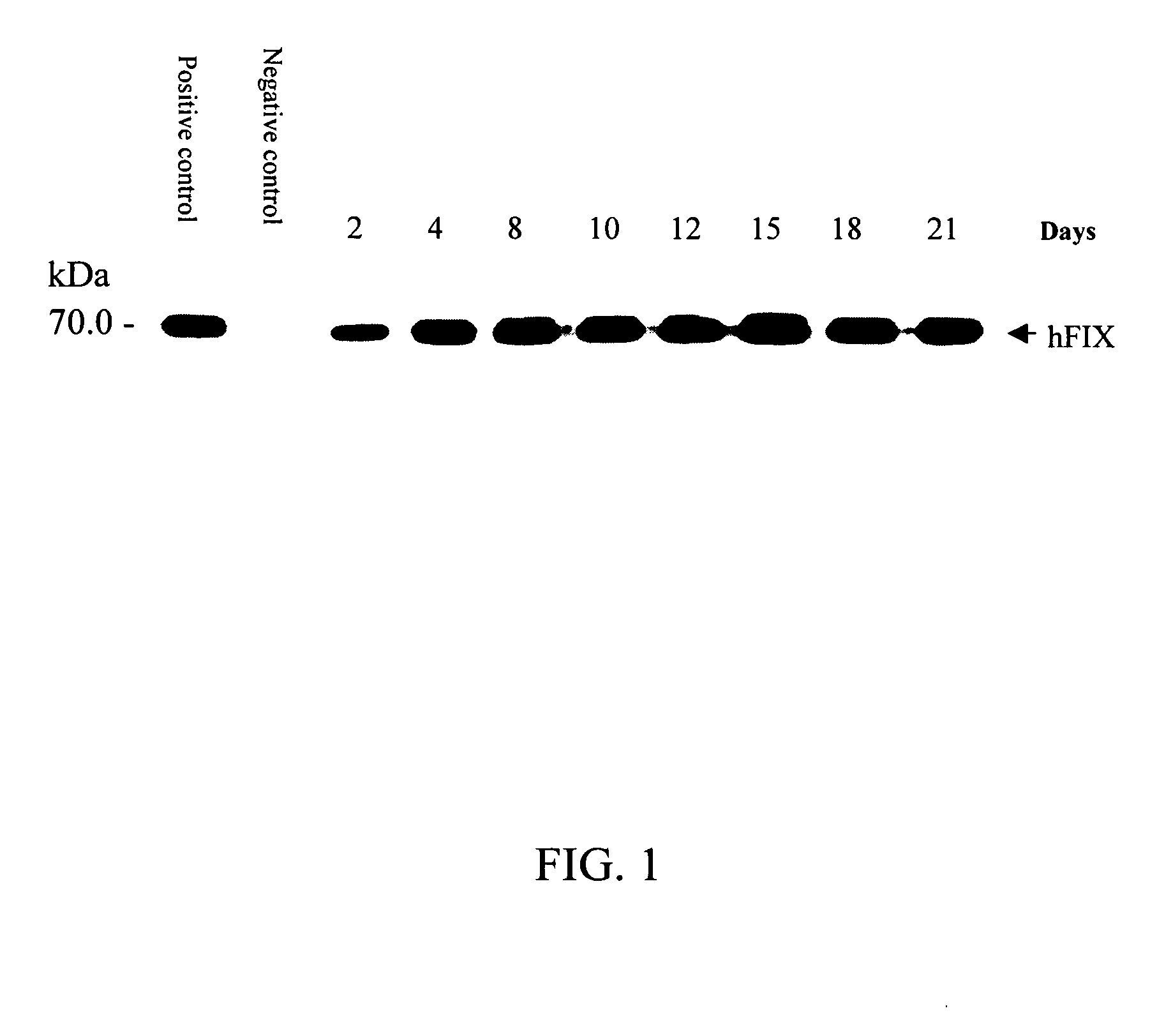 Method for expressing multiple recombinant proteins in milk of transgenic non-human mammals