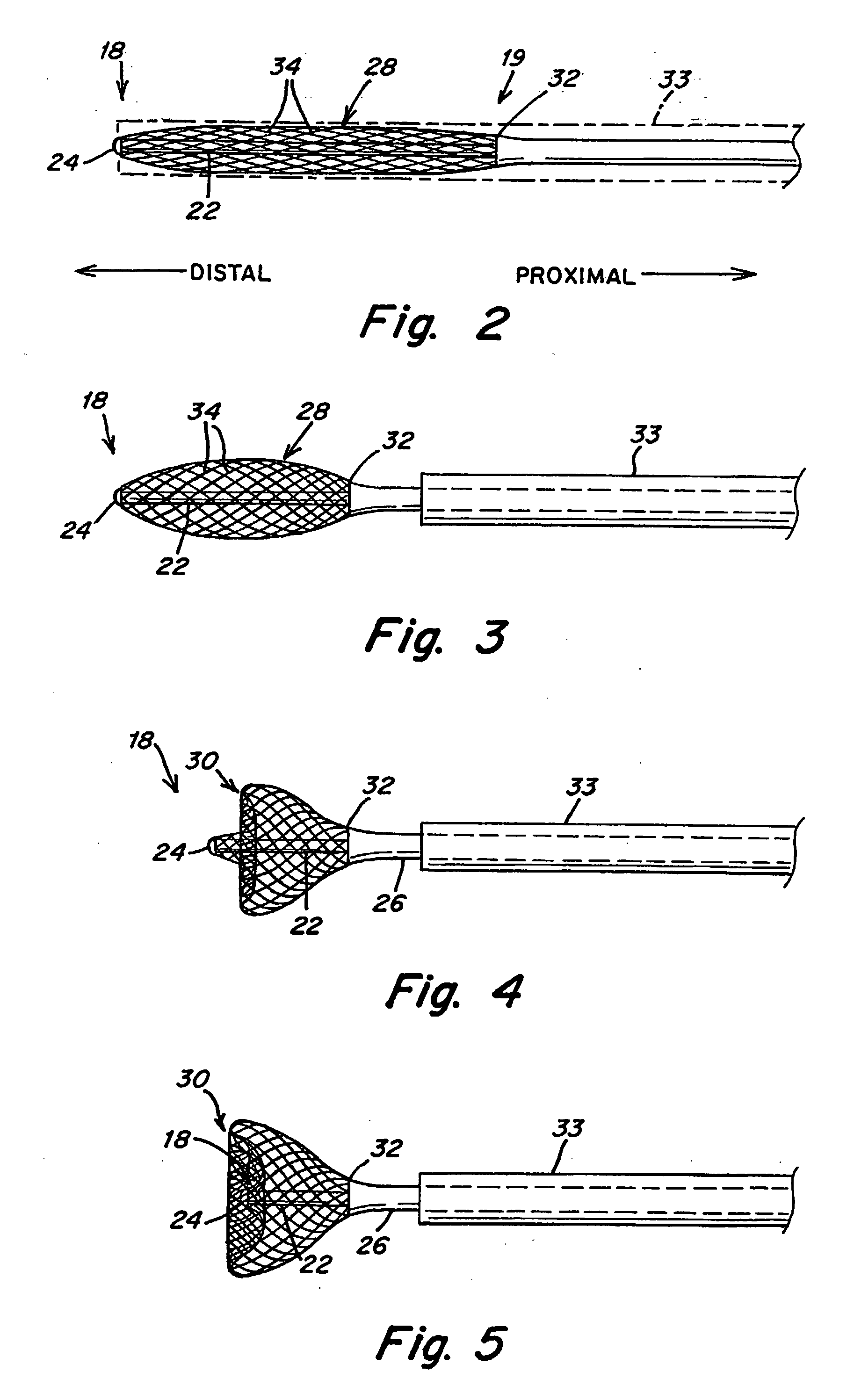 Method and Apparatus for Mapping and/or Ablation of Cardiac Tissue