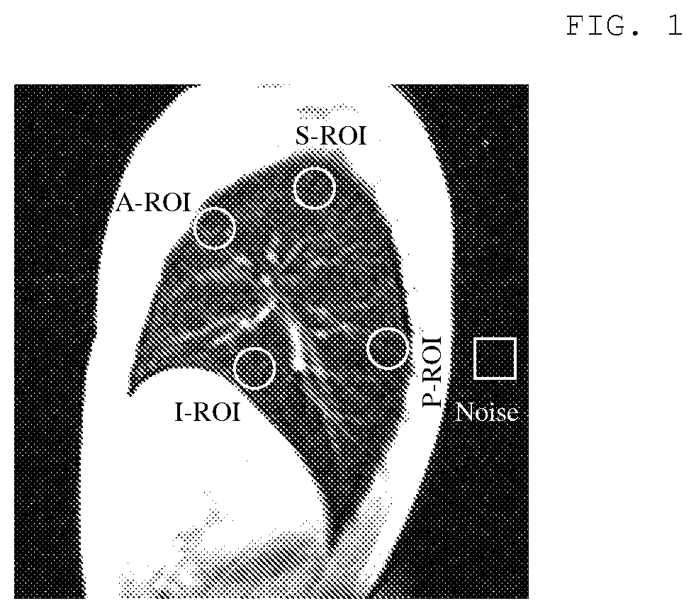 Method and system for performing upright magnetic resonance imaging of various anatomical and physiological conditions
