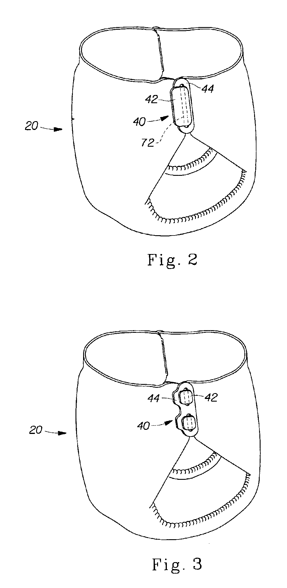 Absorbent article fastening device