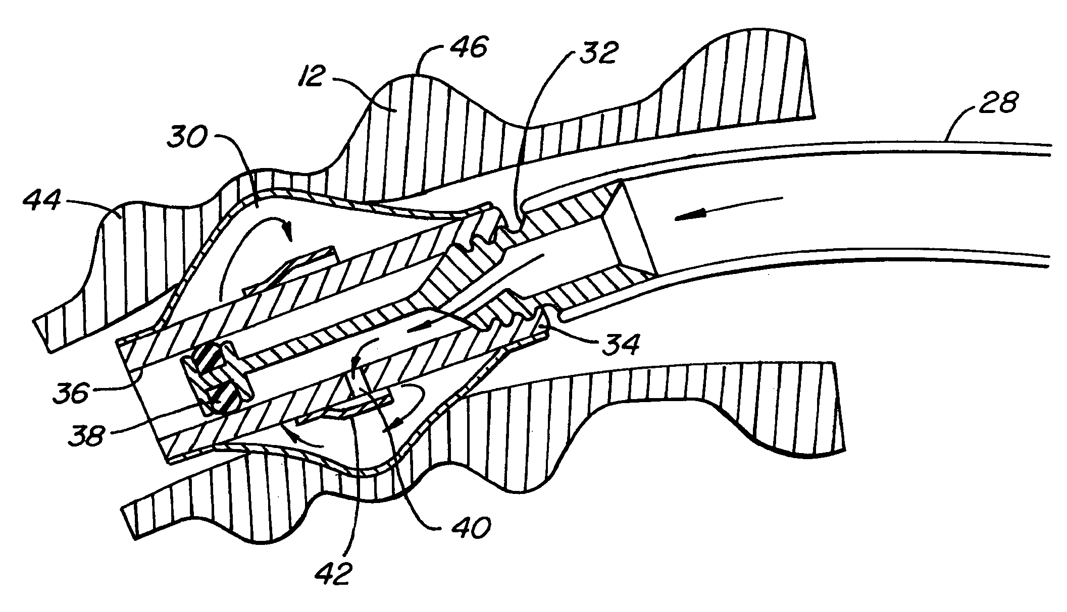 Method of reducing collateral flow in a portion of a lung