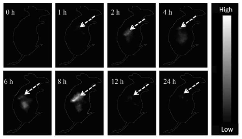 A near-infrared second-region imaging contrast agent and its preparation method and use