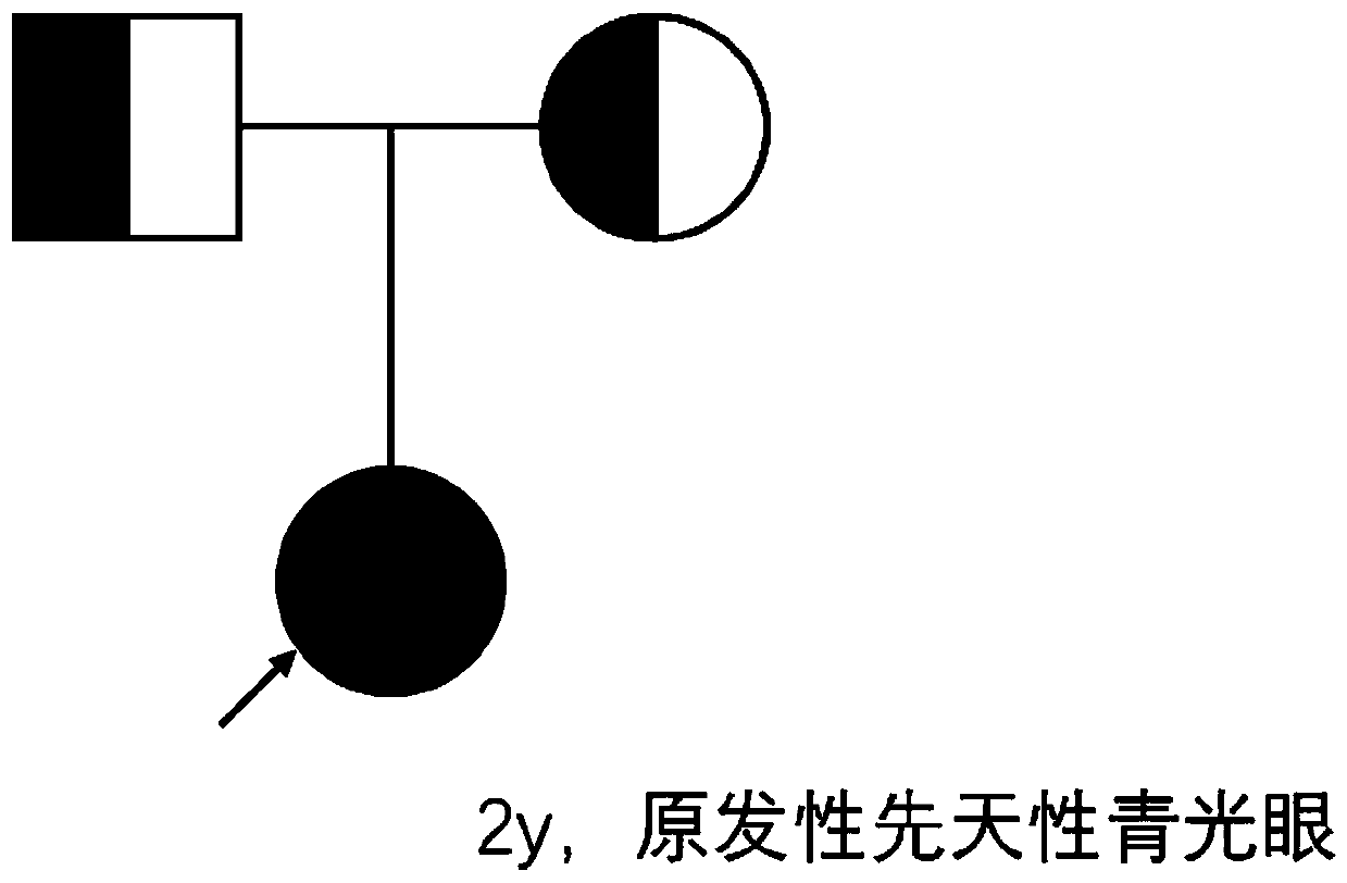 Nucleic acid encoding CYP1B1 gene mutant and applications thereof