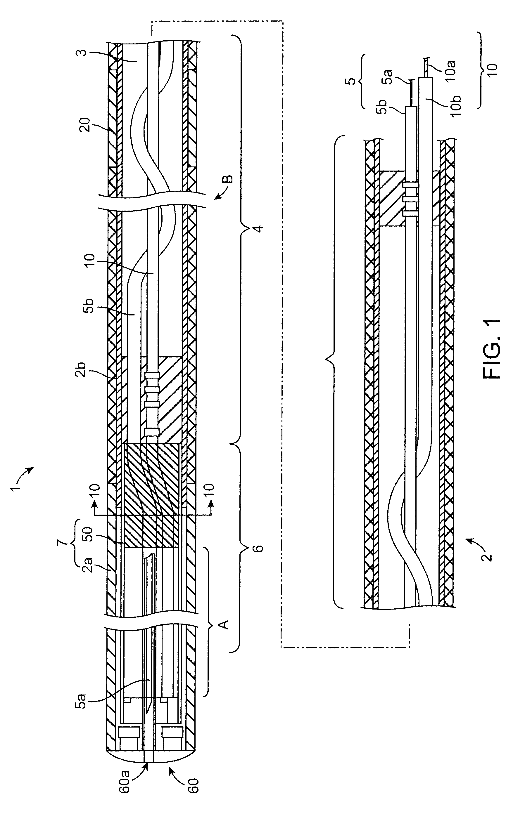 Agent delivery catheters