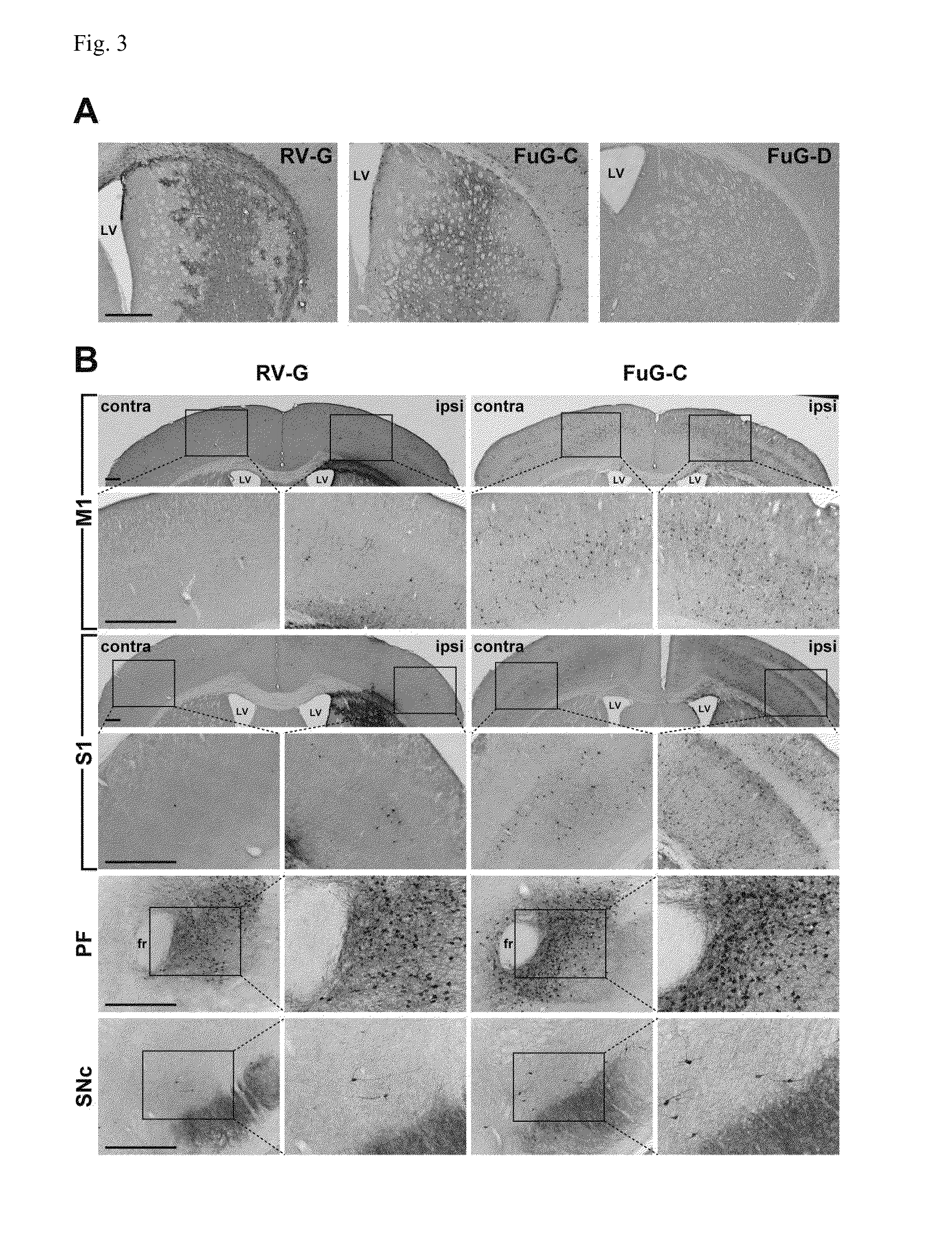 Neuron-specific retrograde transport vector