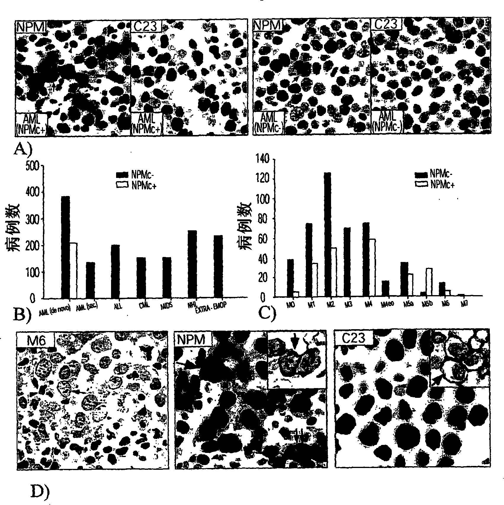 Nucleophosmin protein (npm) mutants, corresponding gene sequences and uses thereof