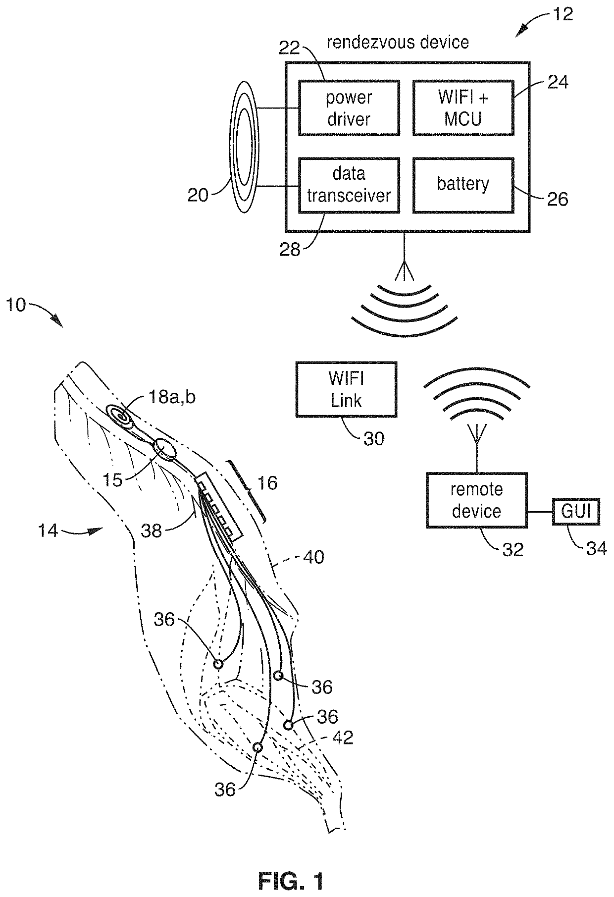 Wireless implant for motor function recovery after spinal cord injury