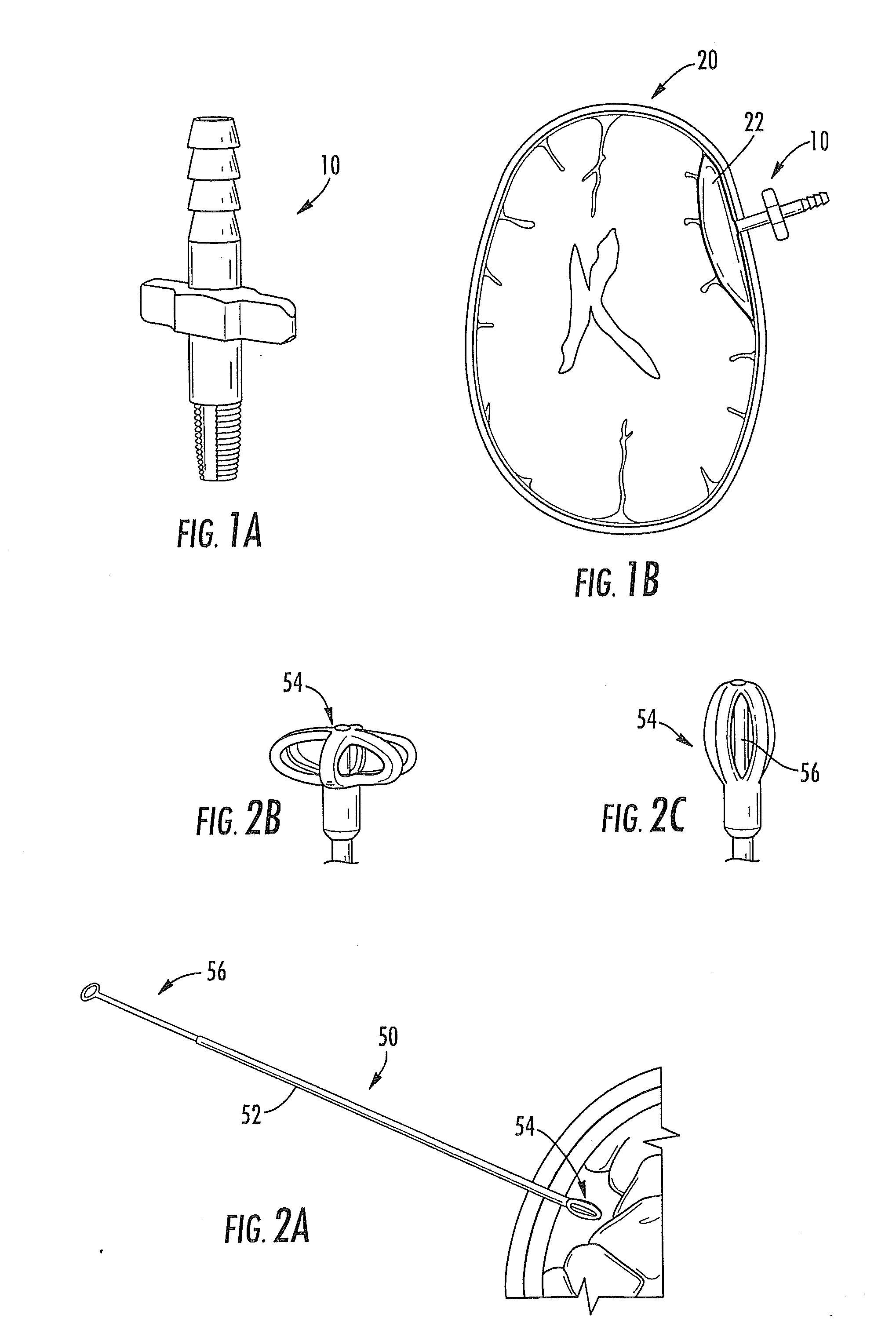 Subdural Drainage Catheter with Self Contained Mechanism for Restoration of Flow Following Catheter Obstruction