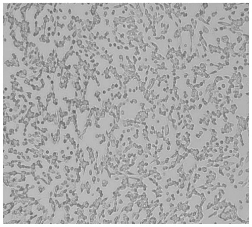 Biomarker for diagnosing ovarian cell apoptosis and injury caused by heavy metal uranium