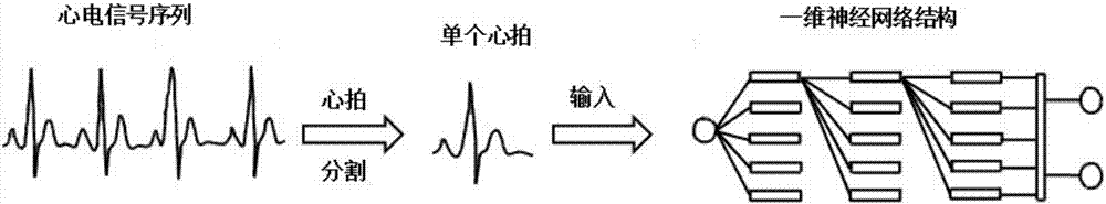 Ventricular ectopic beat detection method based on 1D convolutional neural network